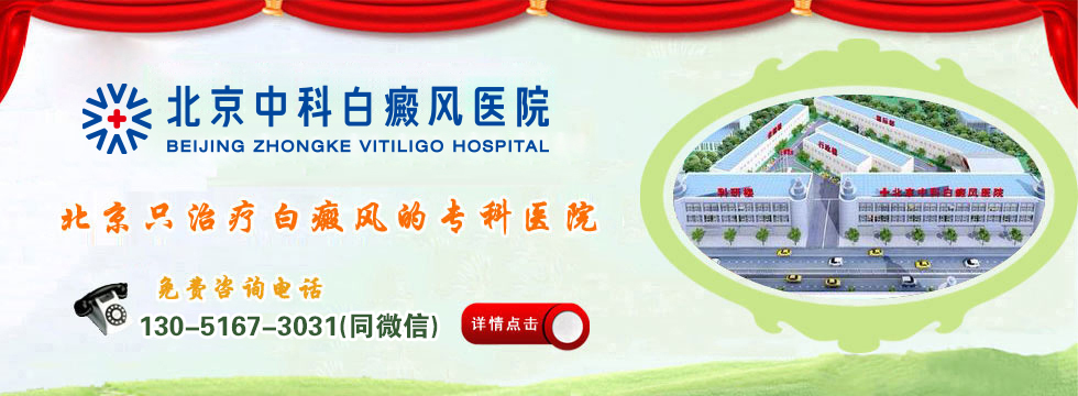 北京白癜风权威医院